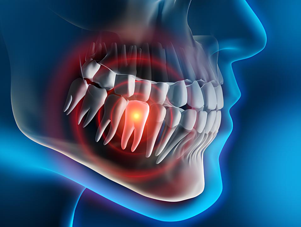Teeth image - Emergency dentist Leatherhead